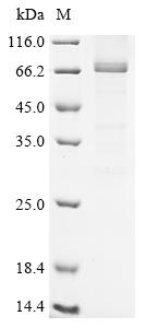 Greater than 85% as determined by SDS-PAGE.Recombinant Human Serine/Threonine-Protein Kinase Rio3 (RIOK3) Protein (His)