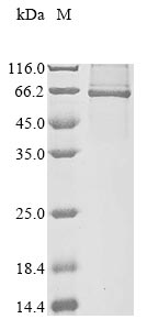 Greater than 85% as determined by SDS-PAGE.Recombinant Human E3 Ubiquitin-Protein Ligase Rnf8 (RNF8) Protein (His&Myc)