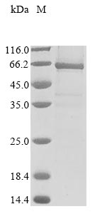 Greater than 85% as determined by SDS-PAGE.Recombinant Human E3 Ubiquitin-Protein Ligase Rnf8 (RNF8) Protein (His&Myc)