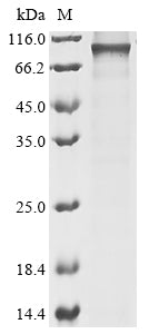 Greater than 85% as determined by SDS-PAGE.Recombinant Mouse Ribosomal Protein S6 Kinase Alpha-4 (RPS6KA4) Protein (His)