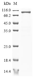 Greater than 85% as determined by SDS-PAGE.Recombinant Mouse Ribosomal Protein S6 Kinase Alpha-4 (RPS6KA4) Protein (His&Myc)