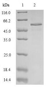 Greater than 85% as determined by SDS-PAGE.Recombinant Human Pulmonary Surfactant-Associated Protein B (SFTPB) Protein (MBP)