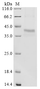 Greater than 85% as determined by SDS-PAGE.Recombinant Human U1 Small Nuclear Ribonucleoprotein A (SNRPA) Protein (His)