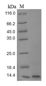 Greater than 85% as determined by SDS-PAGE.Recombinant Mouse Small Proline-Rich Protein 2B (SPRR2B) Protein (His&Myc)