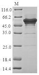 Greater than 85% as determined by SDS-PAGE.Recombinant Human Lupus La Protein (SSB) Protein (His&Myc)