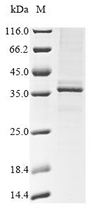 Greater than 85% as determined by SDS-PAGE.Recombinant Mouse Beta-Tectorin (TECTB) Protein (His&Myc)