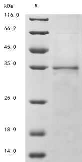 Greater than 85% as determined by SDS-PAGE.Recombinant Human Tumor Necrosis Factor-Inducible Gene 6 Protein (TNFAIP6) Protein (His&Myc)