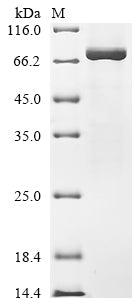 Greater than 90% as determined by SDS-PAGE.Recombinant Human Dna Topoisomerase 1 (TOP1) Protein (His)