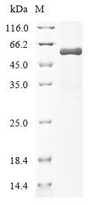 Greater than 85% as determined by SDS-PAGE.Recombinant Human Cellular Tumor Antigen P53 (TP53) Protein (His)