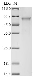 Greater than 90% as determined by SDS-PAGE.Recombinant Human Cellular Tumor Antigen P53 (TP53) Protein (His)