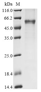 Greater than 85% as determined by SDS-PAGE.Recombinant Human Cellular Tumor Antigen P53 (TP53) Protein (His)