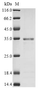 Greater than 85% as determined by SDS-PAGE.Recombinant Human Non-Receptor Tyrosine-Protein Kinase Tyk2 (TYK2) Protein (His)