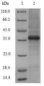 Greater than 85% as determined by SDS-PAGE.Recombinant Human Versican Core Protein (VCAN) Protein (His&Myc)