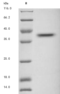 Greater than 85% as determined by SDS-PAGE.Recombinant Human Protein Wnt-2 (WNT2) Protein (His)