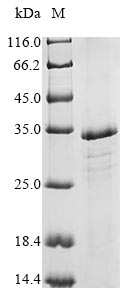 Greater than 85% as determined by SDS-PAGE.Recombinant Hepatitis Delta Virus Genotype I Large Delta Antigen (L-HDAG) Protein (His&Myc)