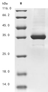 Greater than 85% as determined by SDS-PAGE.Recombinant Zaire Ebolavirus Super Small Secreted Glycoprotein (GP) Protein (His&Myc)