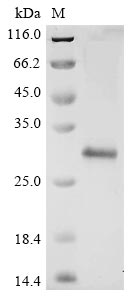 Greater than 85% as determined by SDS-PAGE.Recombinant Avian Infectious Bronchitis Virus Replicase Polyprotein 1Ab (REP) Protein (His)