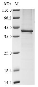 Greater than 85% as determined by SDS-PAGE.Recombinant Murine Polyomavirus Major Capsid Protein Vp1 Protein (His)