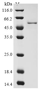 Greater than 90% as determined by SDS-PAGE.Recombinant Human Coronavirus Oc43 Nucleoprotein (N) Protein (His&Myc)