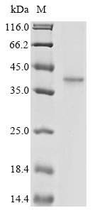 Greater than 85% as determined by SDS-PAGE.Recombinant Human Coronavirus Oc43 Spike Glycoprotein (S) Protein (His&Myc)