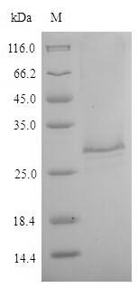 Greater than 85% as determined by SDS-PAGE.Recombinant Toxocara Canis 26 Kda Secreted Antigen (TES-26) Protein (His)