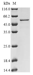 Greater than 85% as determined by SDS-PAGE.Recombinant Human Sars Coronavirus Nucleoprotein (N) Protein (His&Myc)