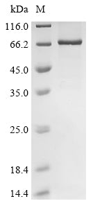 Greater than 85% as determined by SDS-PAGE.Recombinant Akv Murine Leukemia Virus Envelope Glycoprotein (ENV) Protein (GST&His)