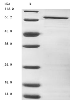 Greater than 85% as determined by SDS-PAGE.Recombinant Vesicular Stomatitis Indiana Virus Matrix Protein (M) Protein (MBP&His)