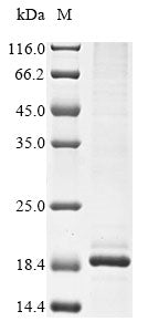 Greater than 85% as determined by SDS-PAGE.Recombinant Mouse Lysozyme C-2 (LYZ2) Protein (His&Myc)