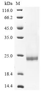 Greater than 90% as determined by SDS-PAGE.Recombinant Hepatitis B Virus Genotype A2 Subtype Adw2 Capsid Protein (C) Protein (His)
