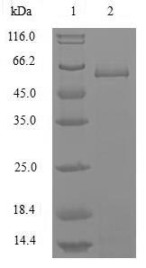 Greater than 85% as determined by SDS-PAGE.Recombinant Influenza B Virus Nucleoprotein (NP) Protein (His)