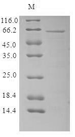 Greater than 85% as determined by SDS-PAGE.Recombinant Human Parvovirus B19 Minor Capsid Protein Vp1 Protein (His&Myc)