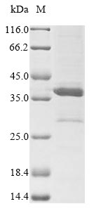 Greater than 85% as determined by SDS-PAGE.Recombinant Human Respiratory Syncytial Virus A Major Surface Glycoprotein G (G) Protein (His&Myc)