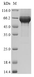 Greater than 85% as determined by SDS-PAGE.Recombinant Rabies Virus Glycoprotein (G) Protein (His)