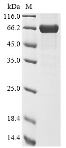 Greater than 85% as determined by SDS-PAGE.Recombinant Bat Coronavirus Hku9 Nucleoprotein (N) Protein (His)