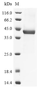 Greater than 85% as determined by SDS-PAGE.Recombinant Human Prostatic Acid Phosphatase (ACP3) Protein (His)