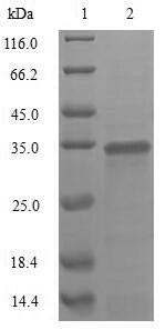 Greater than 85% as determined by SDS-PAGE.Recombinant Rotavirus A Outer Capsid Glycoprotein Vp7 Protein (His&Myc)