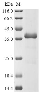 Greater than 90% as determined by SDS-PAGE.