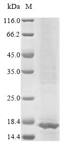 Greater than 85% as determined by SDS-PAGE.Recombinant Human E3 Ubiquitin-Protein Ligase Trip12 (TRIP12) Protein (His&Myc)