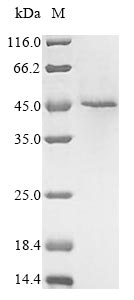 Greater than 85% as determined by SDS-PAGE.Recombinant Human Receptor-Interacting Serine/Threonine-Protein Kinase 1 (RIPK1) Protein (His&Myc)