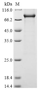 Greater than 85% as determined by SDS-PAGE.Recombinant Human Receptor-Interacting Serine/Threonine-Protein Kinase 1 (RIPK1) Protein (His)