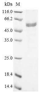 Greater than 85% as determined by SDS-PAGE.Recombinant Human Integrin-Linked Protein Kinase (ILK) Protein (His)