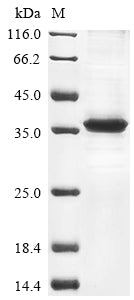 Greater than 85% as determined by SDS-PAGE.Recombinant Human Deoxyribonuclease Gamma (DNASE1L3) Protein (His)
