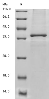Greater than 85% as determined by SDS-PAGE.Recombinant Human Deoxyribonuclease Gamma (DNASE1L3) Protein (His&Myc)