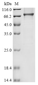 Greater than 85% as determined by SDS-PAGE.Recombinant Human Desmoglein-2 (DSG2) Protein (His)