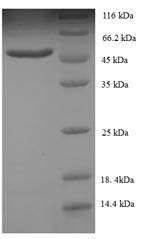 Greater than 90% as determined by SDS-PAGE.Recombinant Human Swi/Snf-Related Matrix-Associated Actin-Dependent Regulator Of Chromatin Subfamily B Member 1 (SMARCB1) Protein (His)