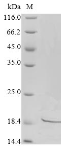 Greater than 90% as determined by SDS-PAGE.Recombinant Human Disco-Interacting Protein 2 Homolog A (DIP2A) Protein (His)