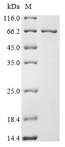 Greater than 85% as determined by SDS-PAGE.Recombinant Human Retinoid Isomerohydrolase (RPE65) Protein (His&Myc)