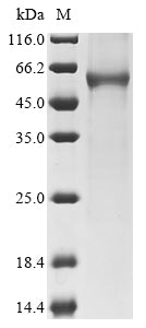 Recombinant Human Keratin, Type I Cytoskeletal 24 (KRT24) Protein (His ...