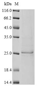 Greater than 85% as determined by SDS-PAGE.Recombinant Bat Coronavirus Hku3 Spike Glycoprotein (S) Protein (His)